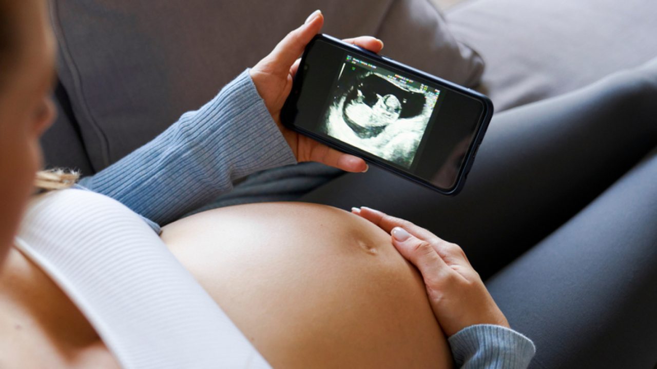 Niveles progesterona óptimos para quedarte embarazada? Arnott